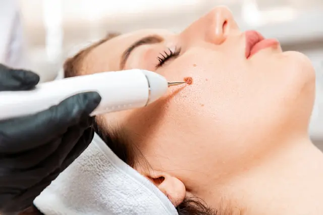 Expert Tips for Choosing the Best Aesthetic Clinic in London